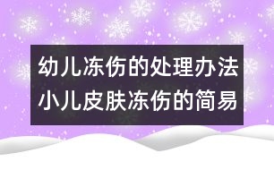 幼兒凍傷的處理辦法：小兒皮膚凍傷的簡易療法