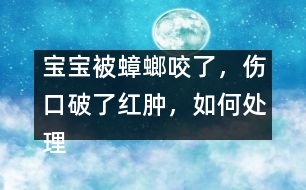 寶寶被蟑螂咬了，傷口破了紅腫，如何處理