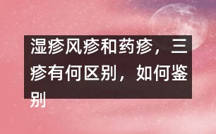 濕疹風(fēng)疹和藥疹，三疹有何區(qū)別，如何鑒別